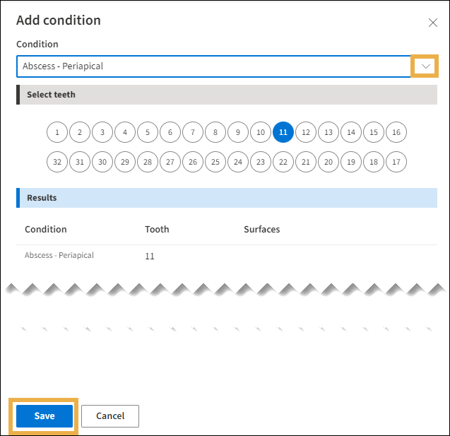 Add Condition window with yellow highlight box around the down-arrow menu and the Save button.